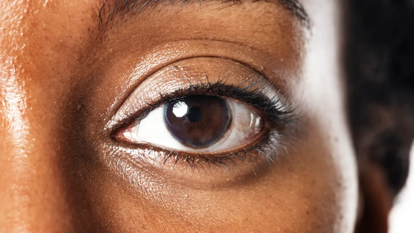 Plasma Eye Lift treatment